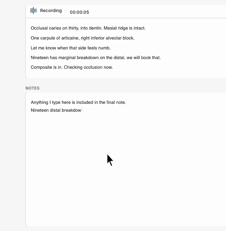 ClinicFrame recording a dental appointment, with the live transcript showing occlusal caries called out on tooth thirty and one carpule of articaine, and a free-text notes field below it.