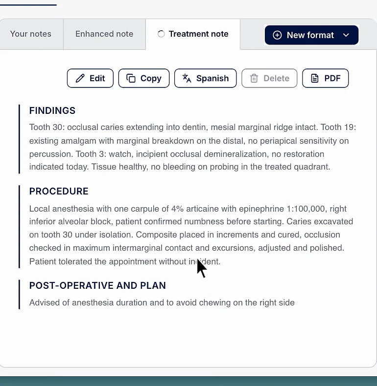 The finished dental treatment note in ClinicFrame with findings by tooth, the procedure and the post-operative plan, and the format tab set to Treatment note.